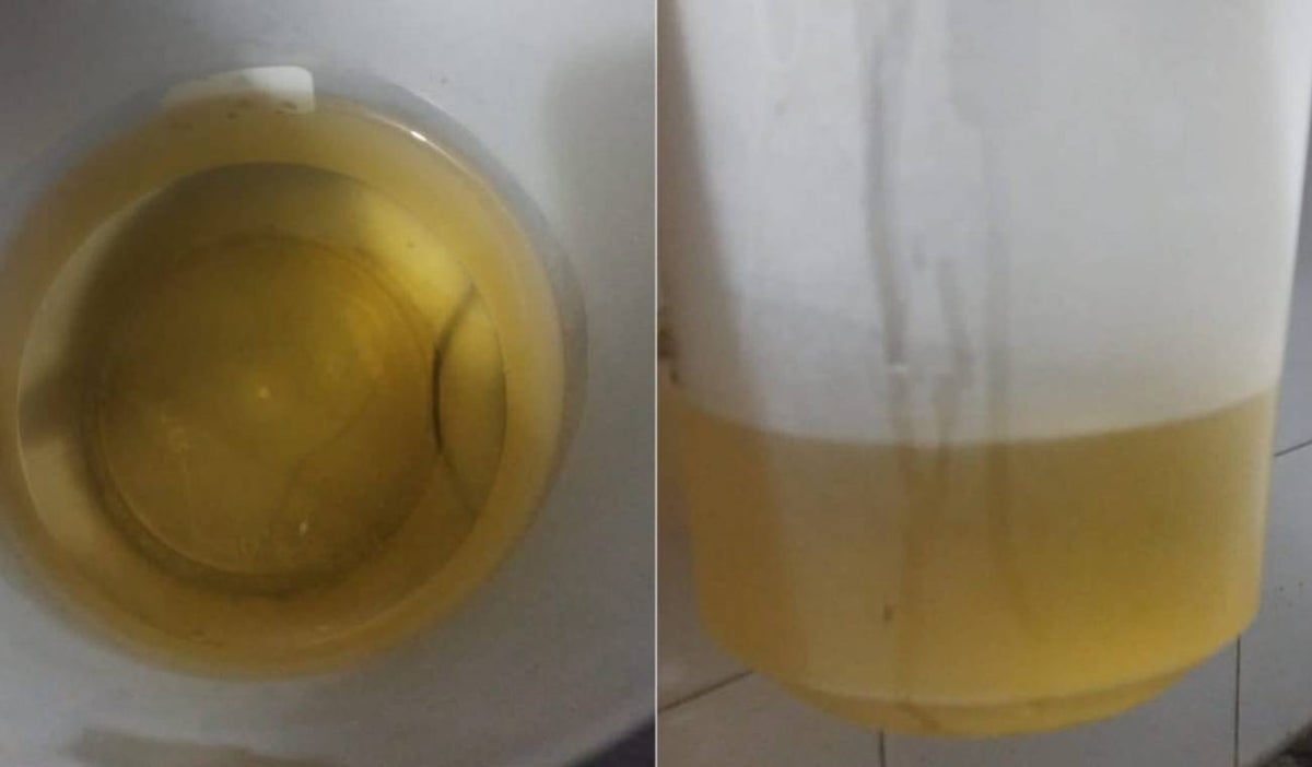 Agua amarilla