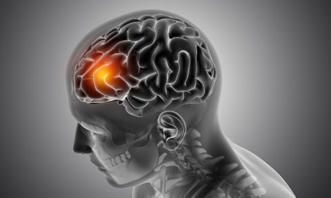 Daño cerebral, tumores, dolor de cabeza