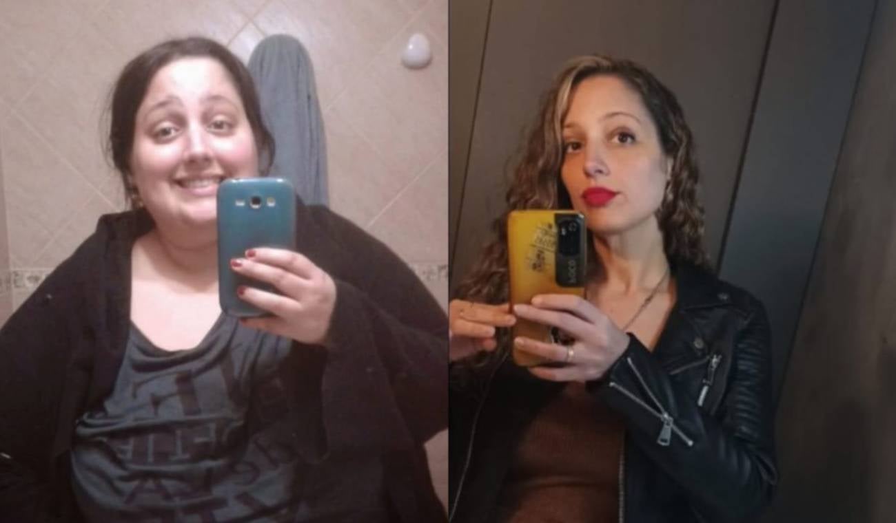 Mujer perdió 100 kilos