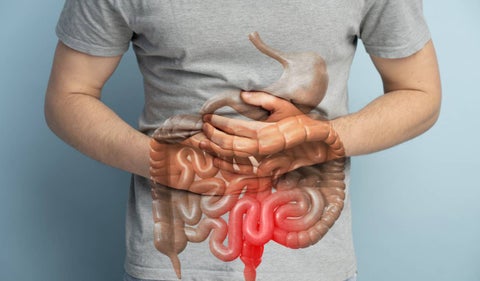 Enfermedad de crohn