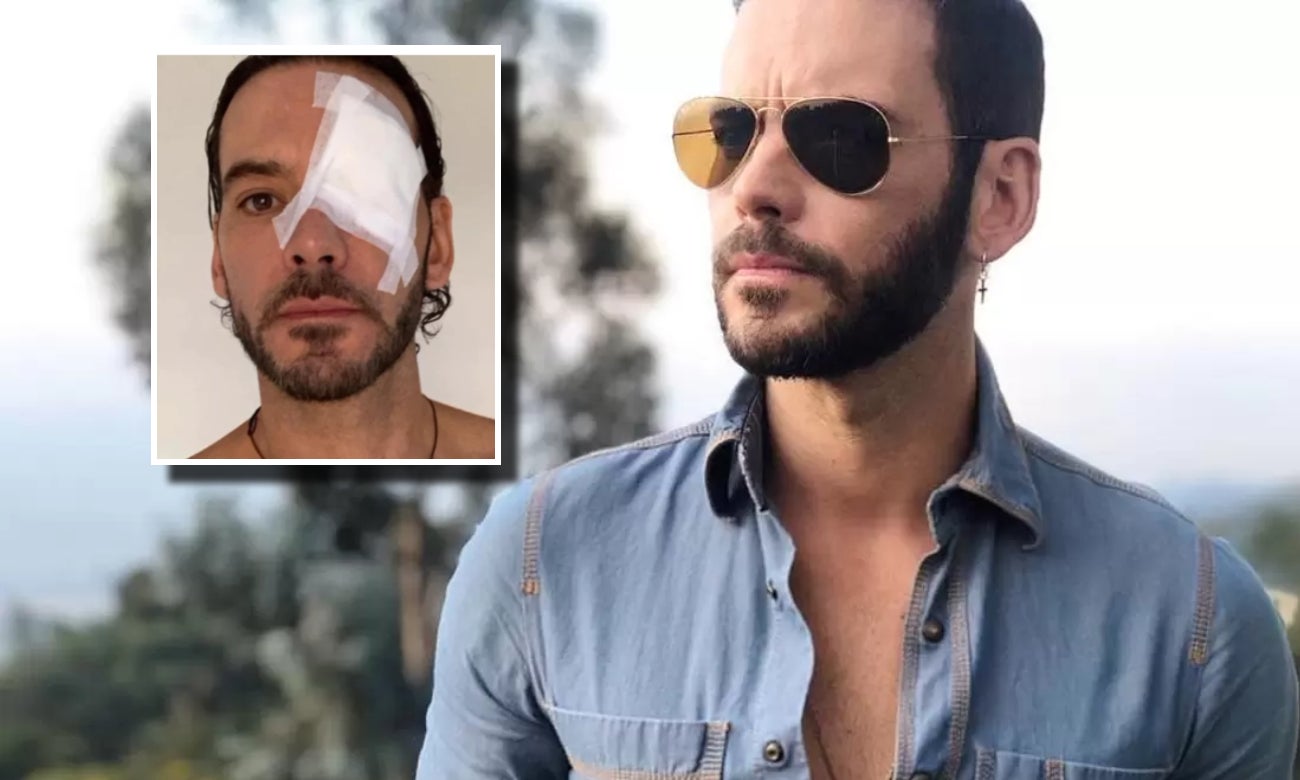 Diego Cadavid tuvo fuerte accidente y se “rompió la cabeza"