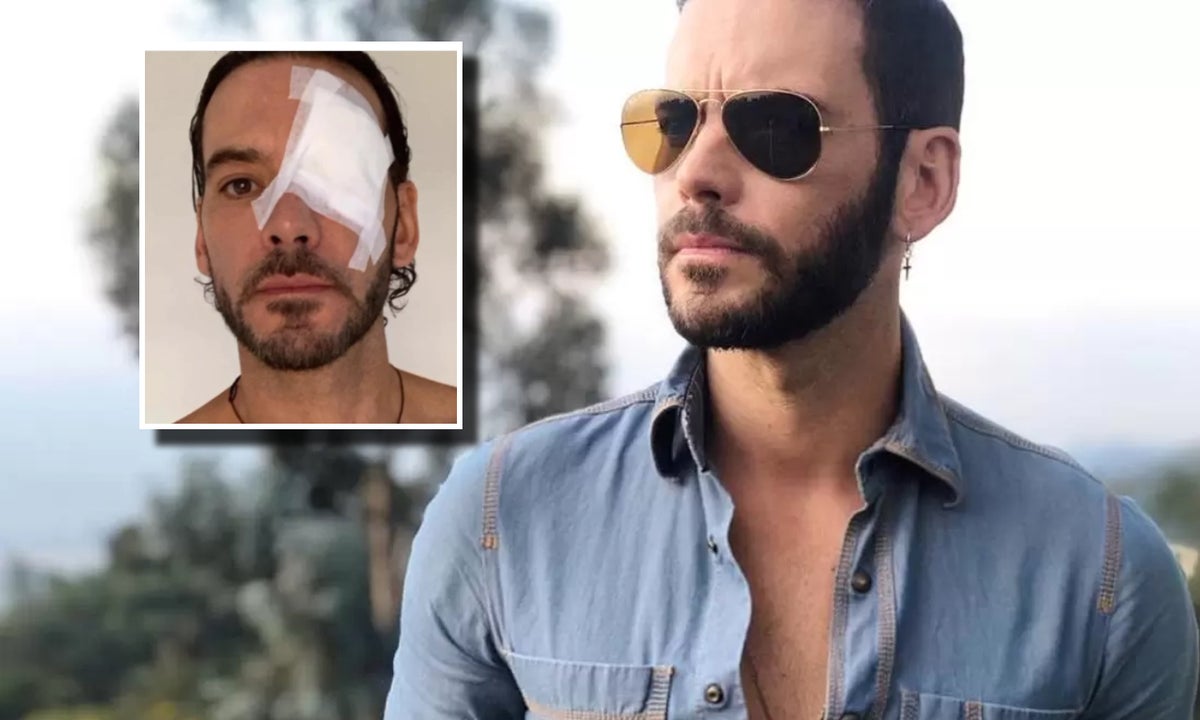 Diego Cadavid tuvo fuerte accidente y se “rompió la cabeza"