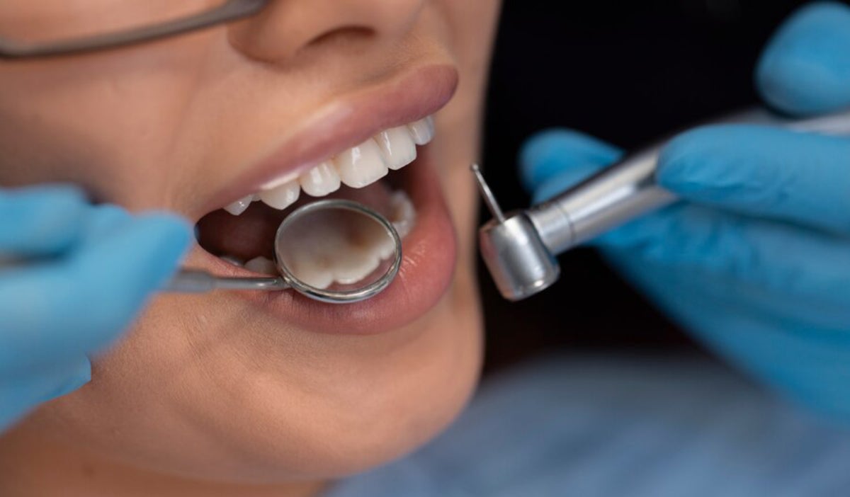 Blanquear los dientes con productos naturales