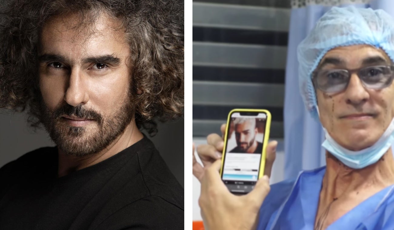 ¡Insólito! Miguel Varoni se transforma en Maluma con un retoque estético.
