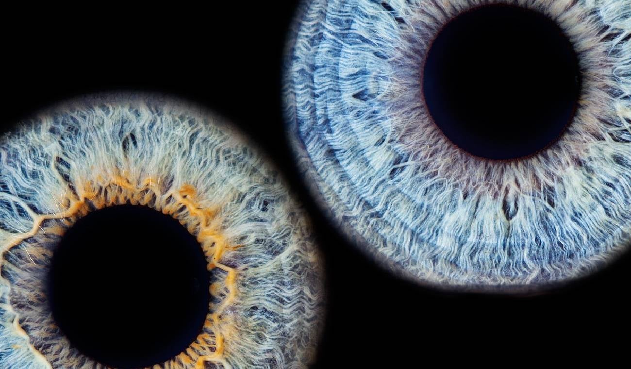 Iris de ojos: Obra de arte en Bogotá