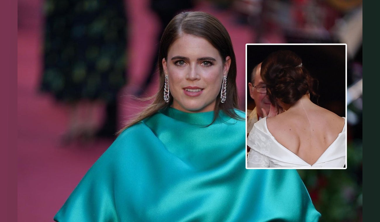 La verdad detrás de la gran cicatriz de la princesa Eugenia