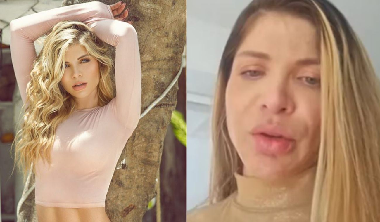 Angelica Jaramillo antes y después