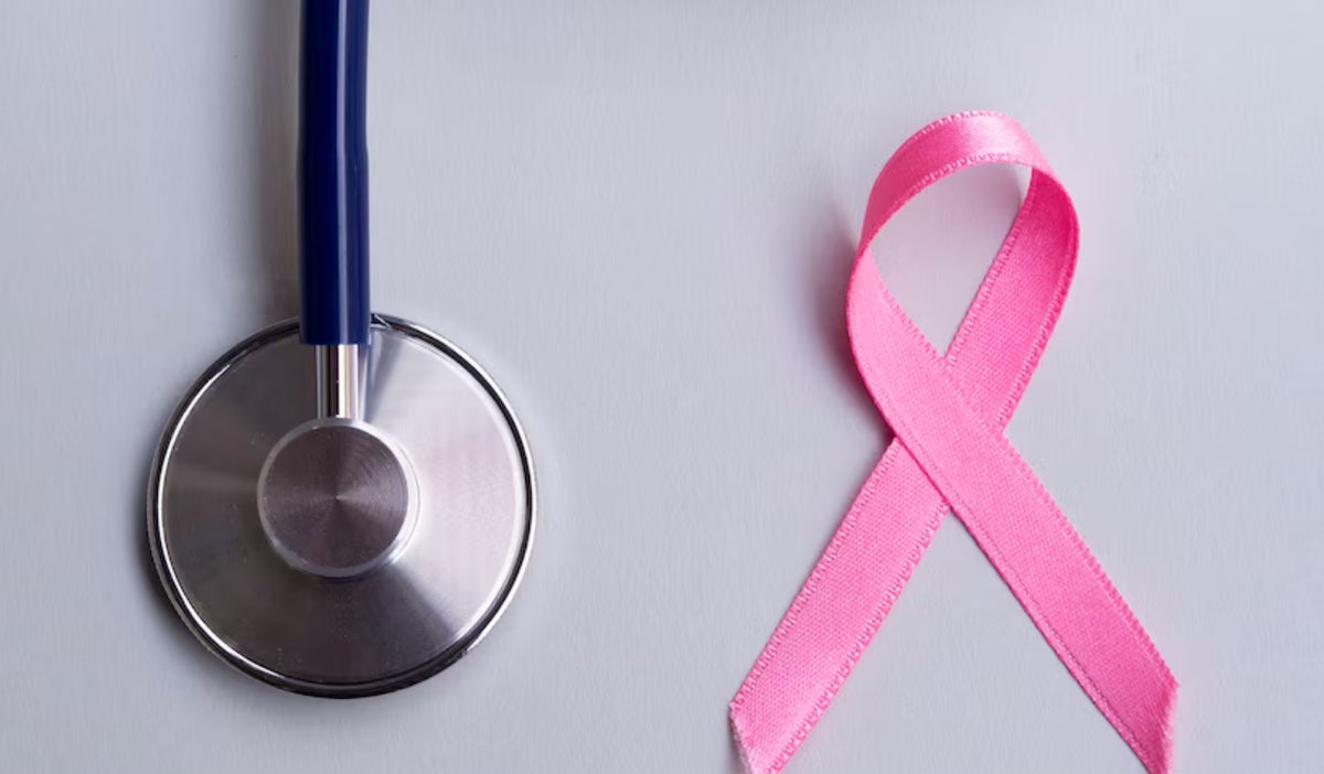 En un gesto de solidaridad y esperanza, se entregará prótesis y pelucas a mujeres que enfrentan el cáncer de mama