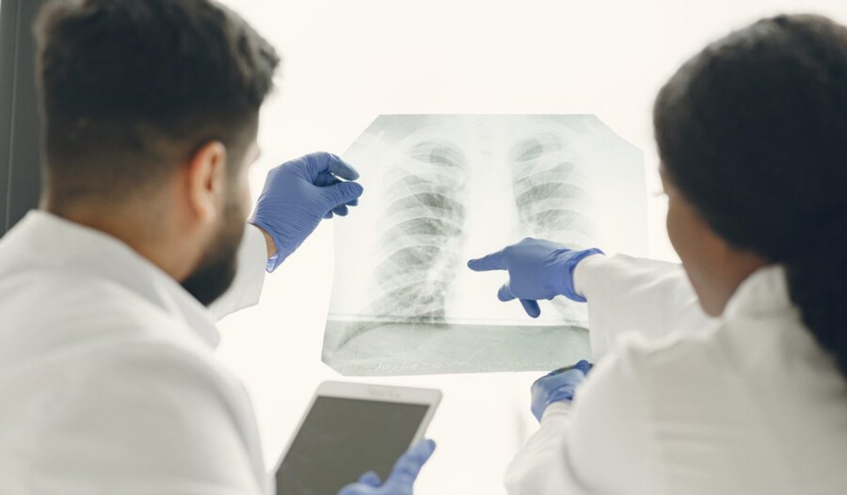 El cáncer de pulmón en Latinoamérica: prevención y detección temprana