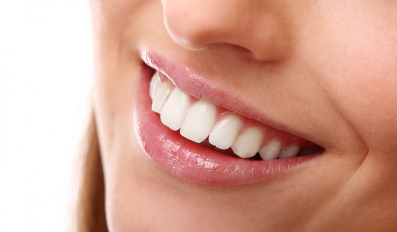 CINCO consejos clave para conservar su DISEÑO de SONRISA