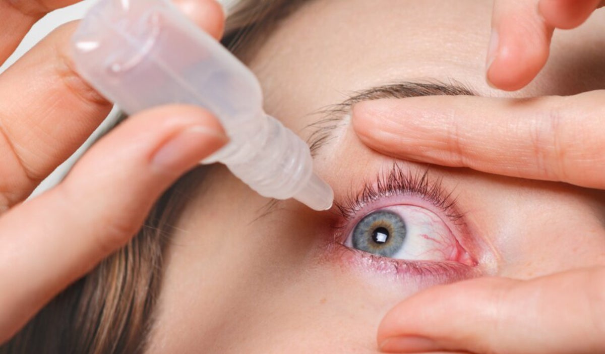 Cómo prevenir la sequedad ocular