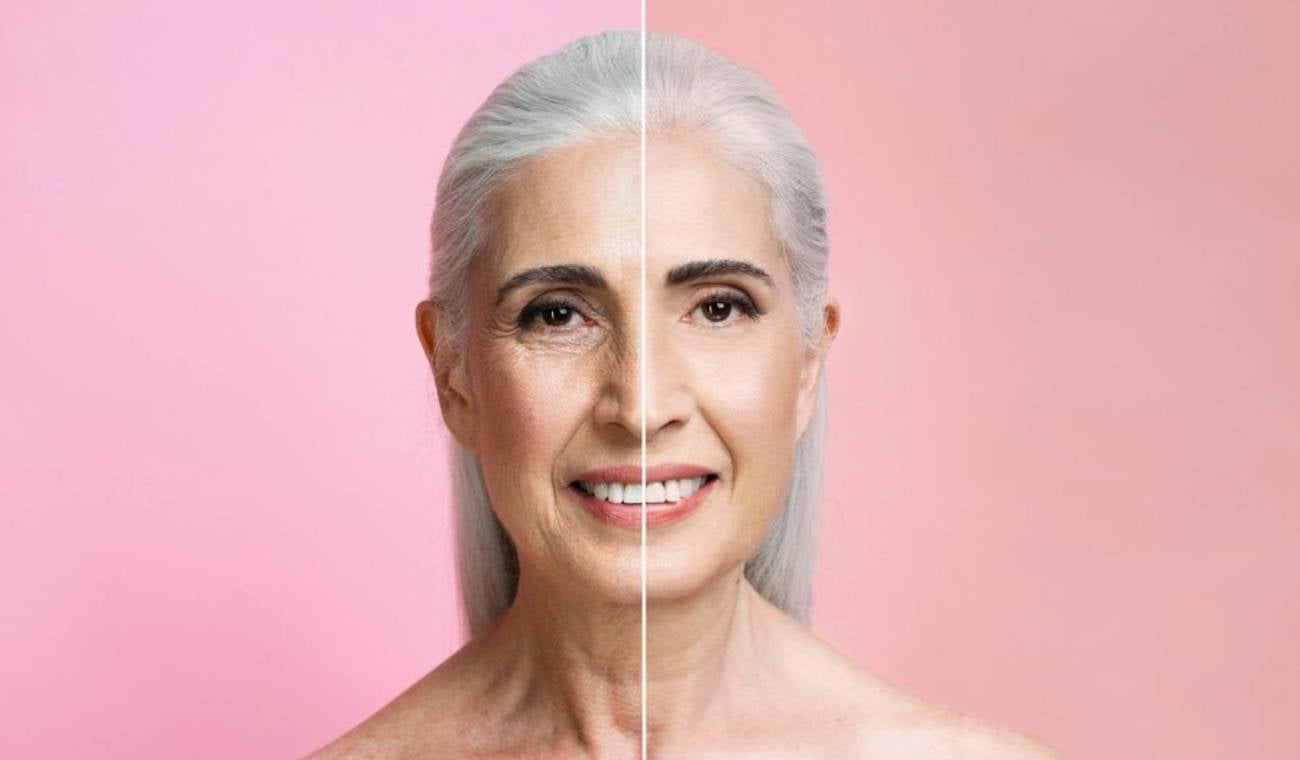 Ultherapy Prime, la revolución en rejuvenecimiento facial sin cirugías
