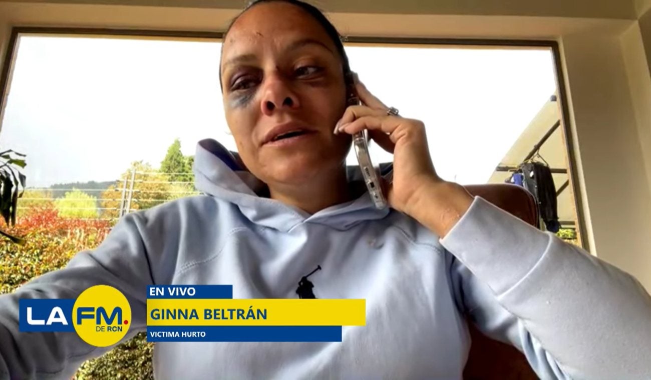 Gina Beltrán, víctima de brutal hurto en Chía, denuncia que no le recibieron la denuncia a tiempo