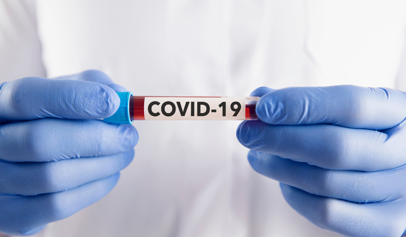 La CIA cambia su postura sobre el origen del covid19