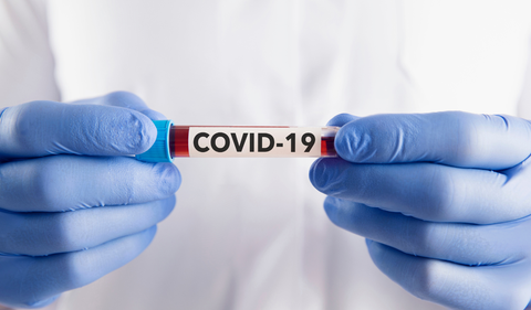 La CIA cambia su postura sobre el origen del covid19