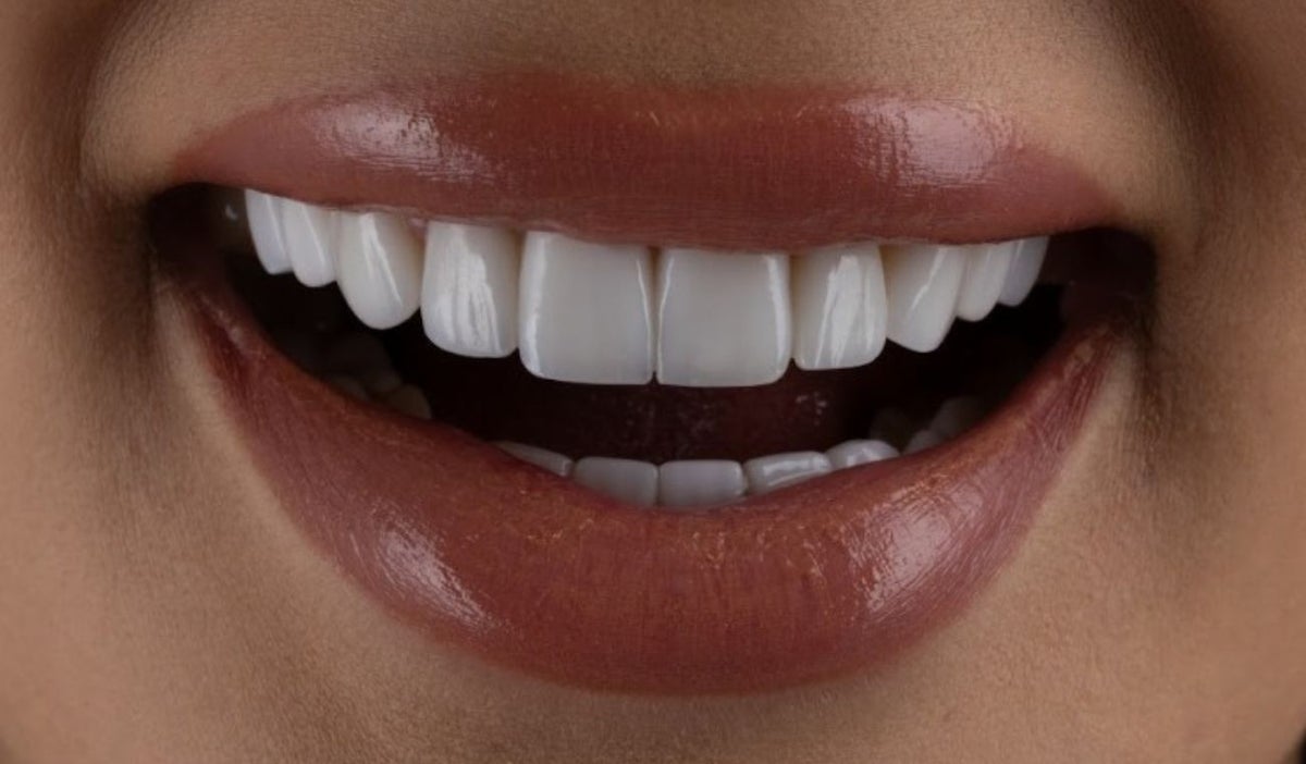 diseño de sonrisa