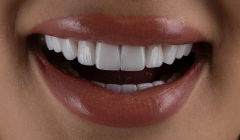 diseño de sonrisa