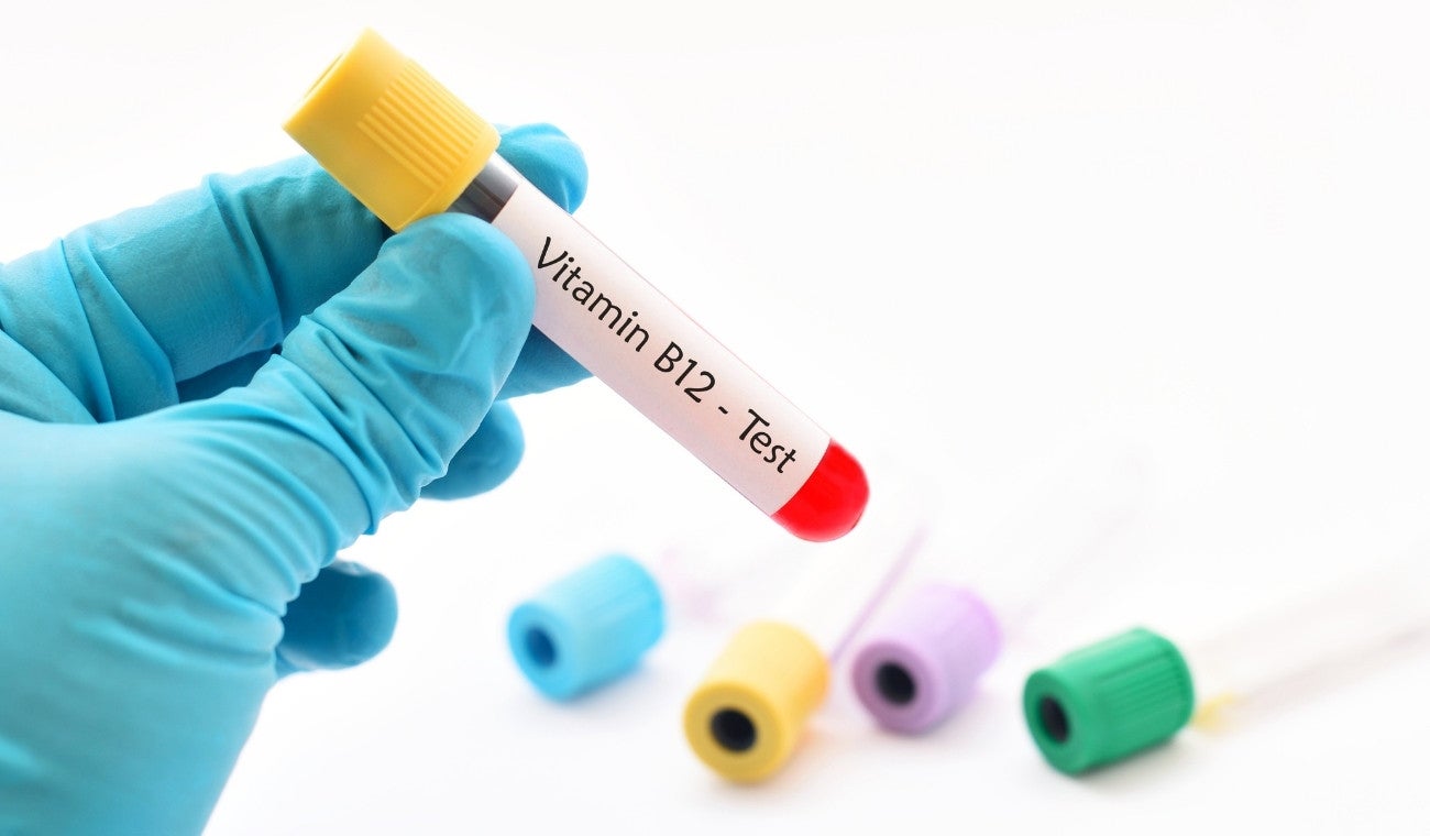 Beneficios de tomar vitamina B12 y cómo se recomienda consumirla