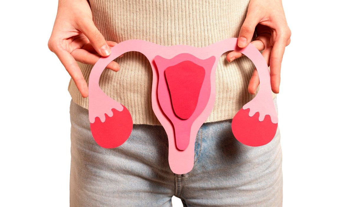 Cáncer de ovario en Colombia