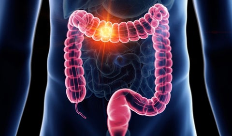 Esta es la mejor fruta para limpiar el colon y cuidar su digestión