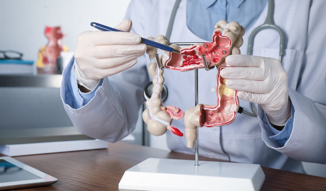 ¿Cuál es la mejor FRUTA para LIMPIAR el COLON?
