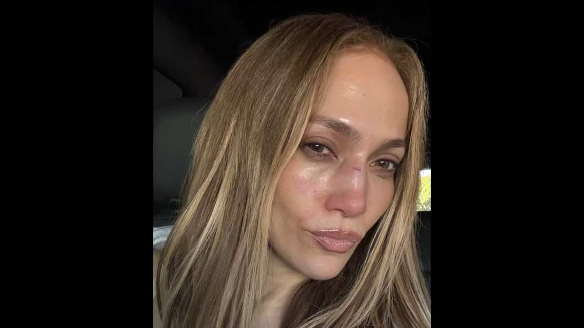 Jennifer López de lastimó la nariz