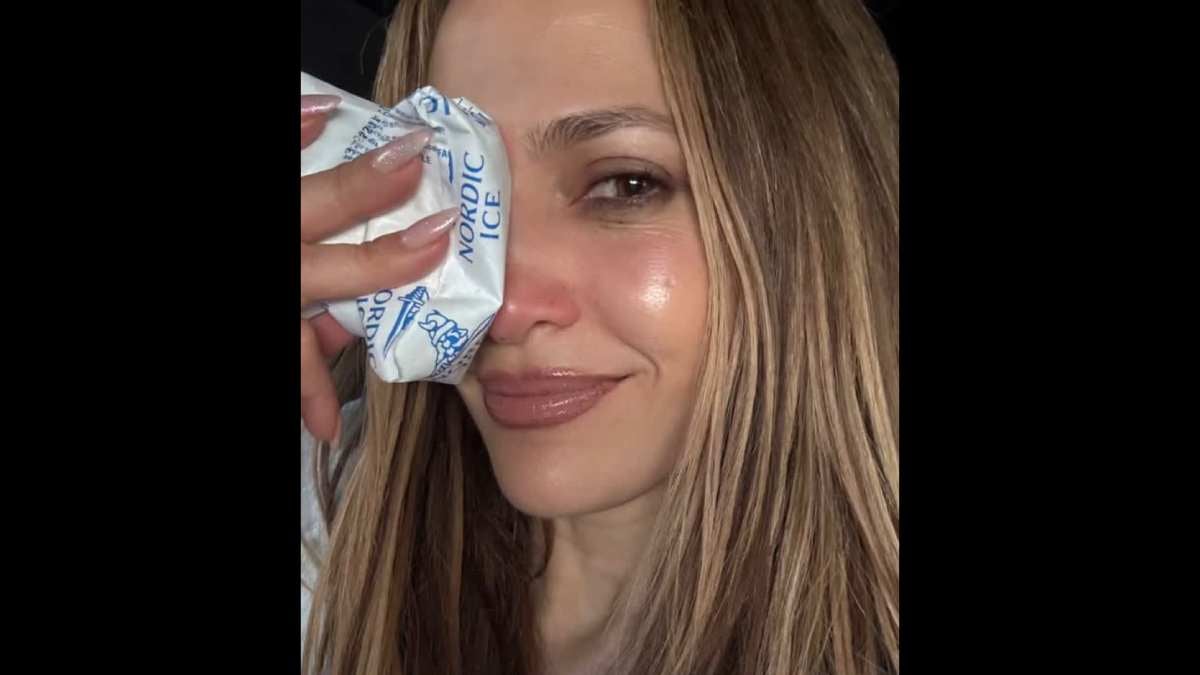 JENNIFER LOPEZ revela FOTOS de su lesión tras fuerte caída