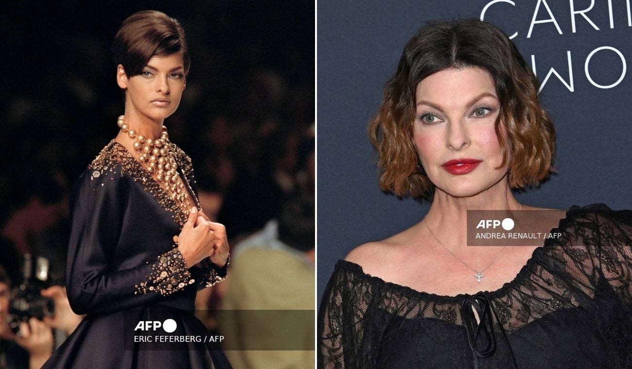 Linda Evangelista víctima de un tratamiento malogrado