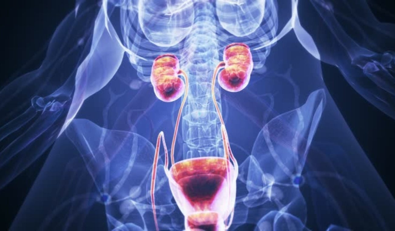 Cáncer de riñón