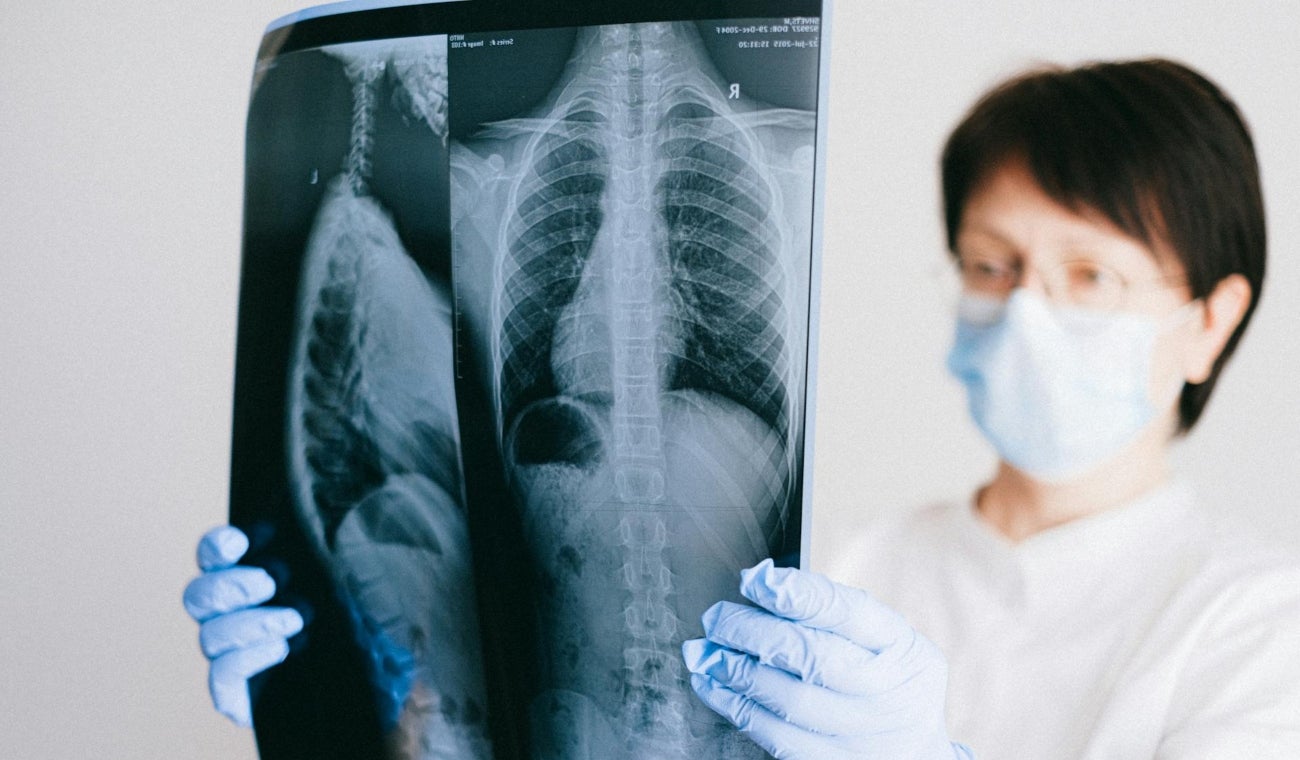 Pulmones
