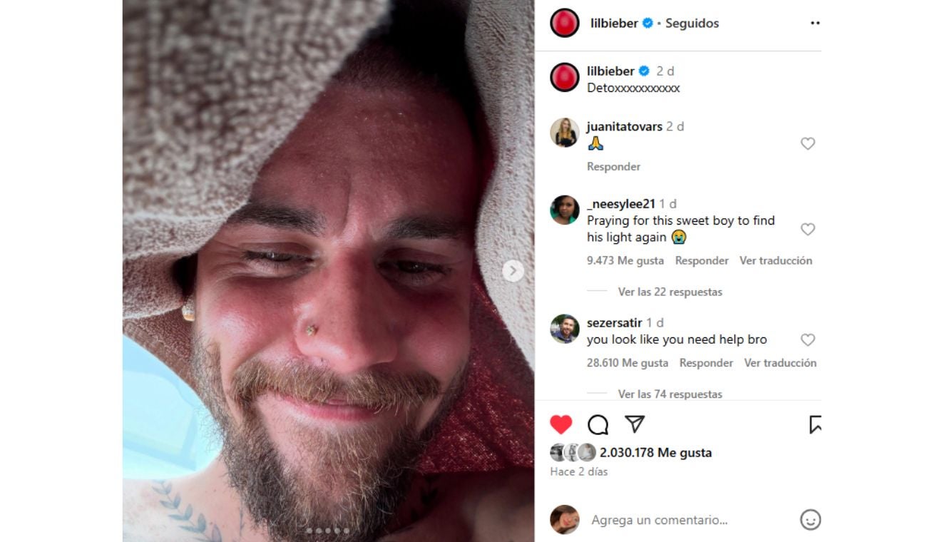 [FOTOS] JUSTIN BIEBER preocupa con alarmantes imágenes
