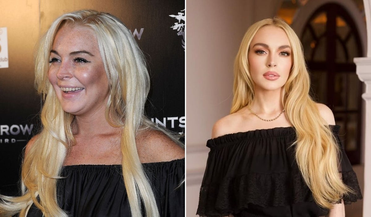 Lindsay Lohan habla sobre su rostro y explica los cambios que se evidencian en su apariencia