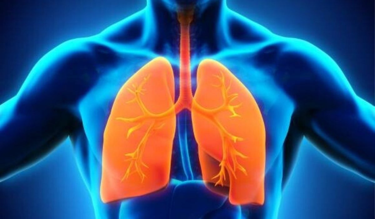 Virus Sincitial Respiratorio (VSR)