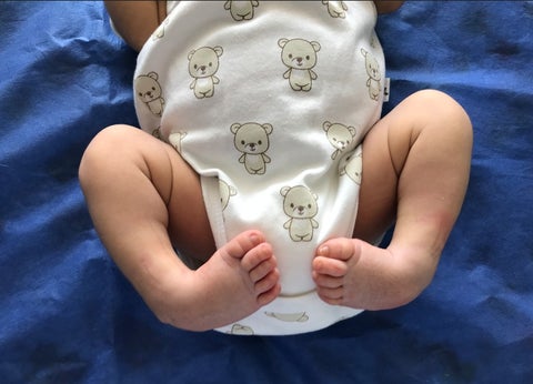 El tratamiento en los bebés.