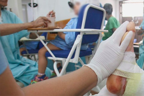 Vuelve y juega con un diciembre con varios quemados con pólvora.