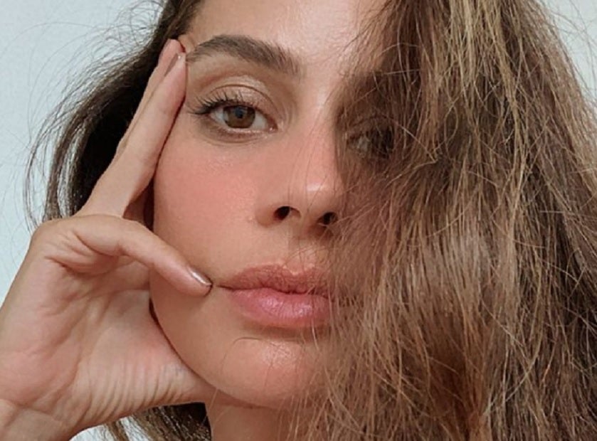 Manuela Gonzalez Accidente De Transito Que Le Dejo Una Cicatriz La Fm Accusato di furto è costretto a nascondersi per sfuggire alla galera e tentare di dimostrare la sua innocenza. la fm