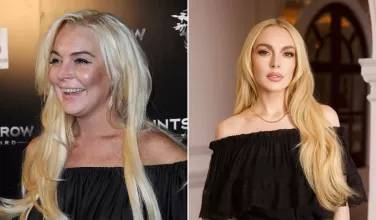 Lindsay Lohan habla sobre su rostro y explica los cambios que se evidencian en su apariencia