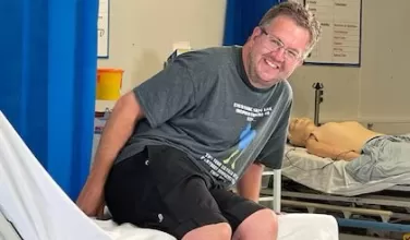 Neil Hopper, cirujano británico que se amputó las piernas