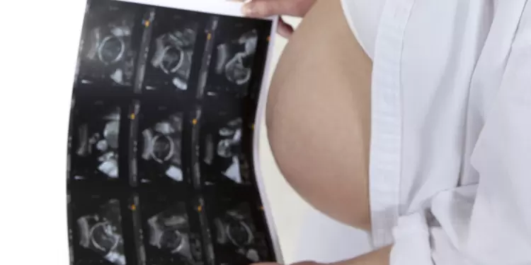 65% de colombianos aprueba la legalización del aborto, según la primera Encuesta de percepción sobre la interrupción de embarazo