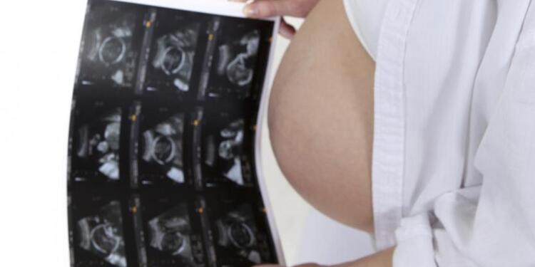 Aborto en Colombia