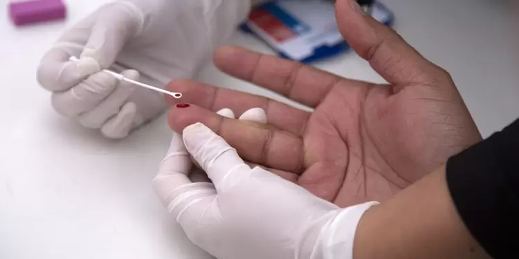 Prueba para detectar el VIH. Prueba VIH