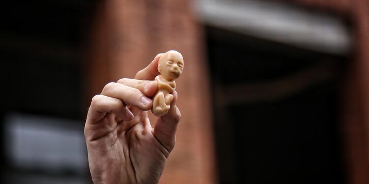 Aborto en Colombia Aborto en Colombia