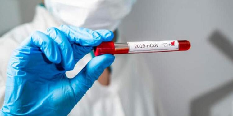 Prueba de coronavirus