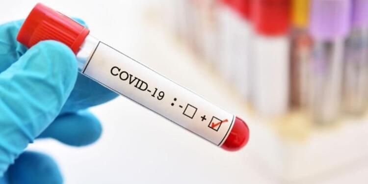 Prueba de coronavirus Prueba de coronavirus