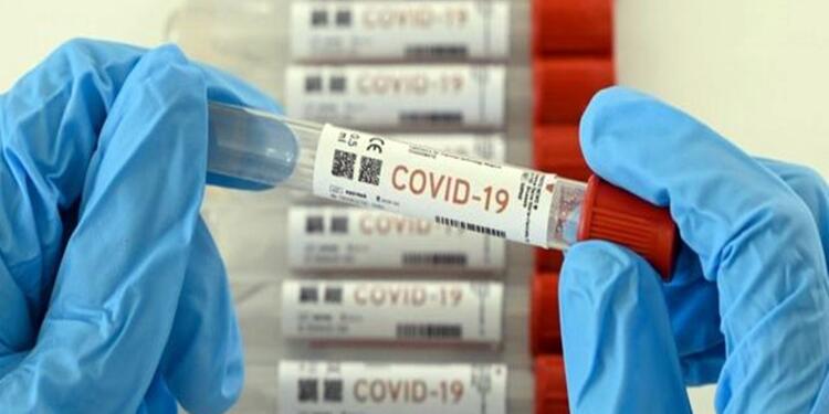 Pruebas Covid-19 imagen de referencia