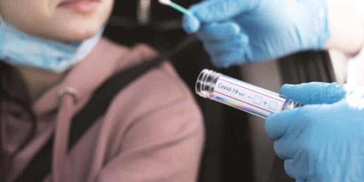 Prueba PCR Prueba PCR