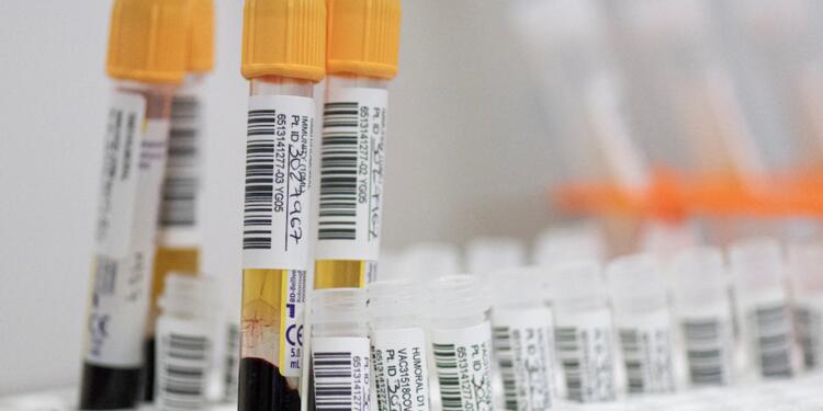 Dosis de vacunas de Janssen - Johnson & Johnson