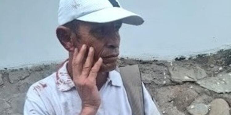 Fredy Escalante Durán, líder atacado