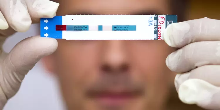 Día mundial del VIH 1 de diciembre: Aumento de infección no diagnosticada Día mundial del VIH 1 de diciembre: Aumento de infección no diagnosticada