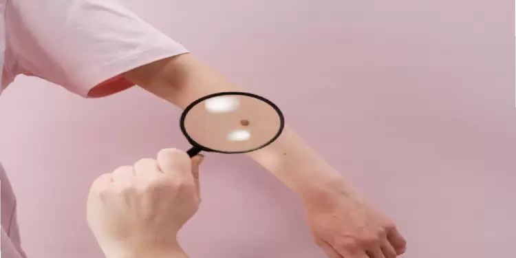 Cuidado de la piel